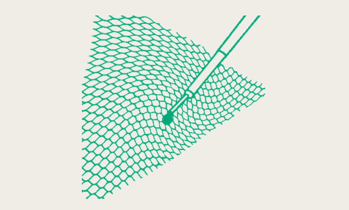 Surgical mesh with the Histoacryl® LapFix applier for mesh fixation